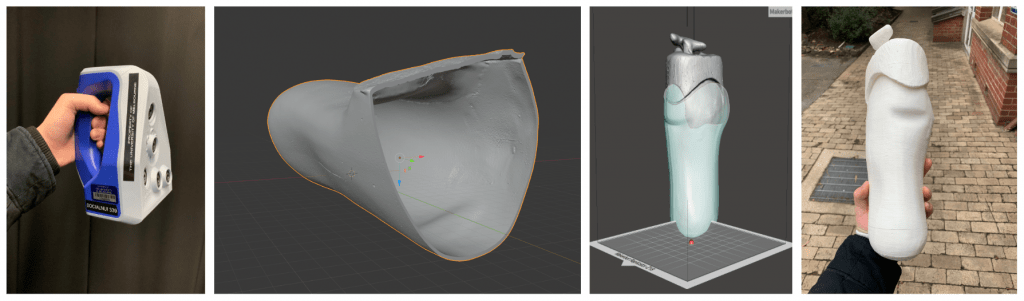 Using a 3D Scanner (left: Artec Space Spider) to create a 3D model of the residual limb; design of a check socket (center images) and 3D-print of mold (right) for the final lamination process.
